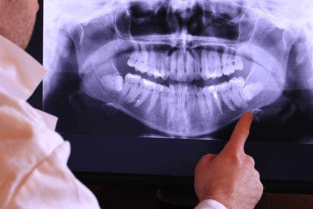 Best Walk-In Emergency Dentist in Wimauma, FL