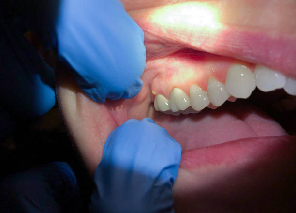 Best Emergency Dental Surgery in Wimauma, FL